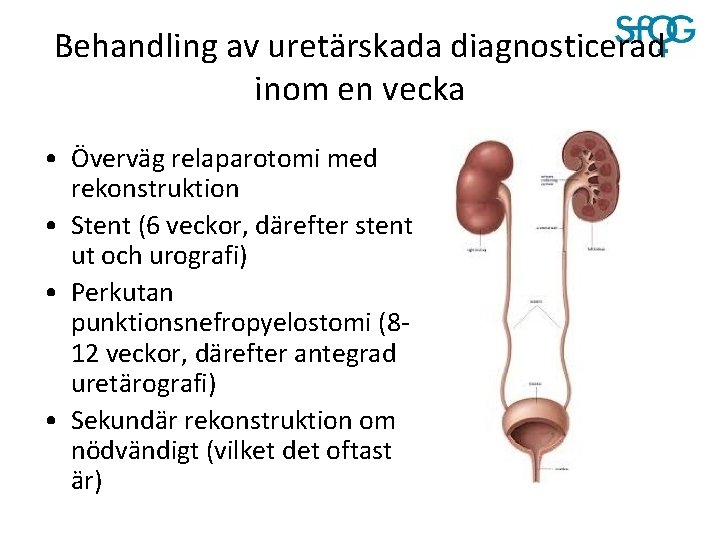 Behandling av uretärskada diagnosticerad inom en vecka • Överväg relaparotomi med rekonstruktion • Stent