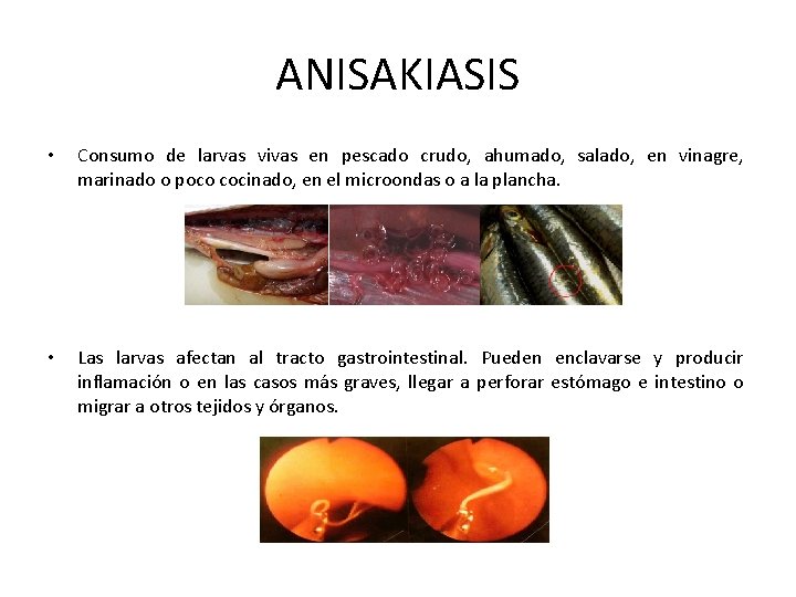 ANISAKIASIS • Consumo de larvas vivas en pescado crudo, ahumado, salado, en vinagre, marinado