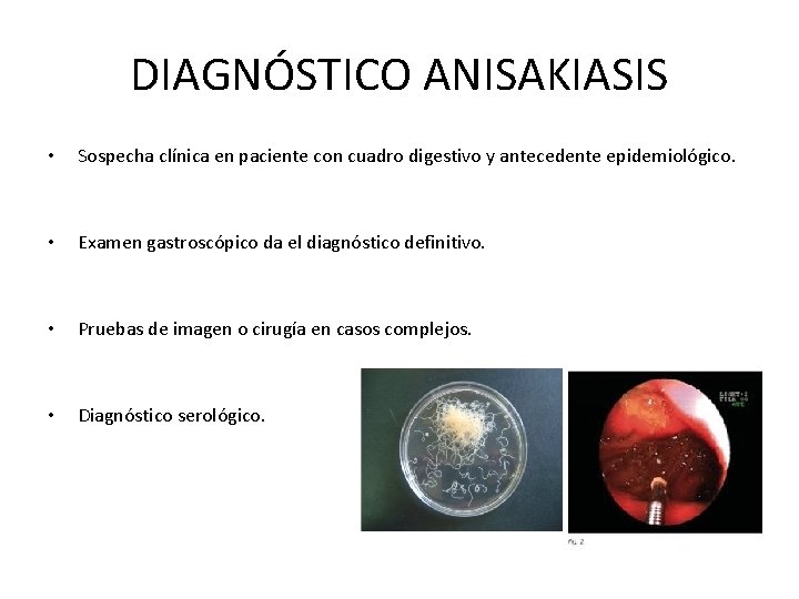 DIAGNÓSTICO ANISAKIASIS • Sospecha clínica en paciente con cuadro digestivo y antecedente epidemiológico. •