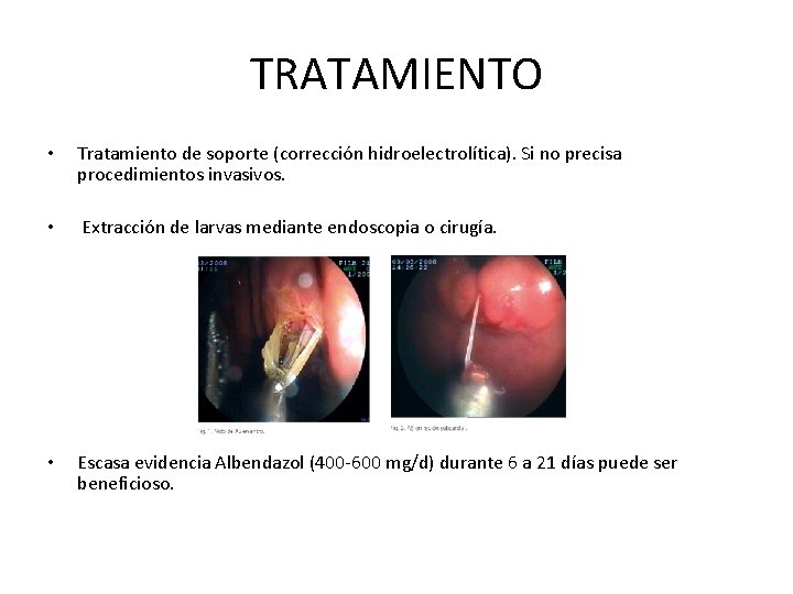 TRATAMIENTO • Tratamiento de soporte (corrección hidroelectrolítica). Si no precisa procedimientos invasivos. • Extracción