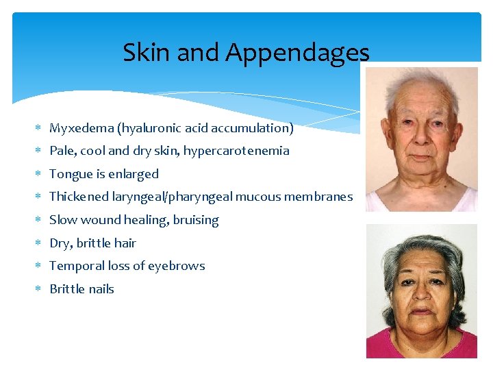 Skin and Appendages Myxedema (hyaluronic acid accumulation) Pale, cool and dry skin, hypercarotenemia Tongue