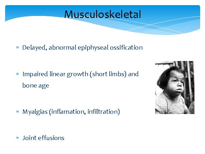 Musculoskeletal Delayed, abnormal epiphyseal ossification Impaired linear growth (short limbs) and bone age Myalgias