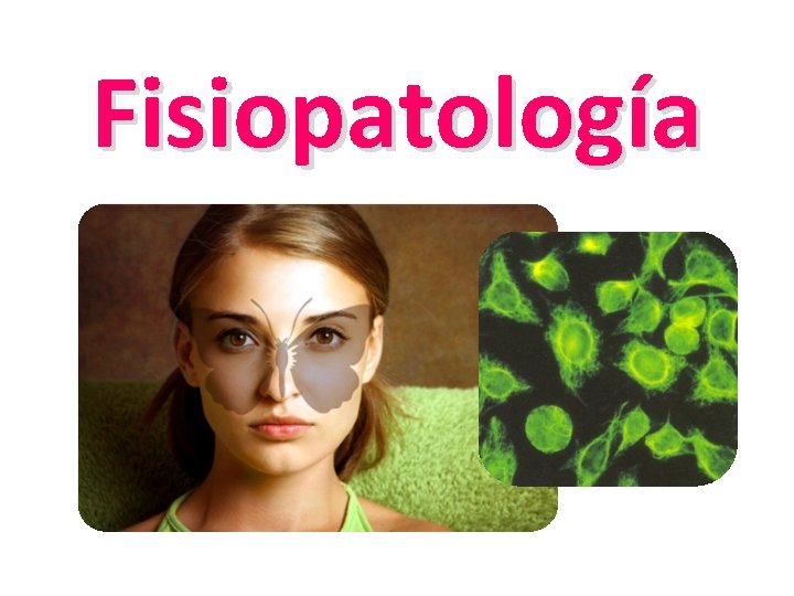 Fisiopatología 