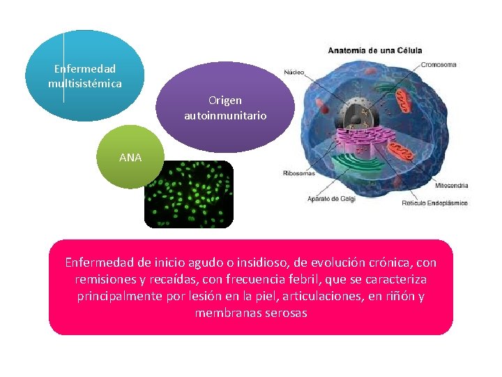 Enfermedad multisistémica Origen autoinmunitario ANA Enfermedad de inicio agudo o insidioso, de evolución crónica,