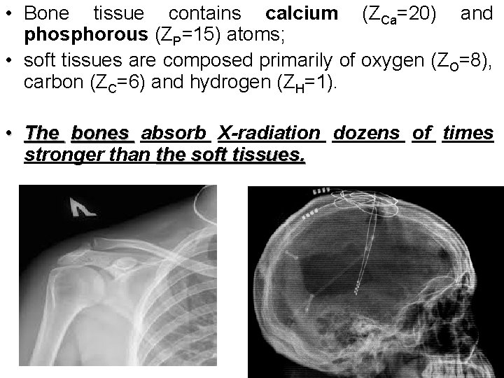  • Bone tissue contains calcium (ZCa=20) and phosphorous (ZP=15) atoms; • soft tissues