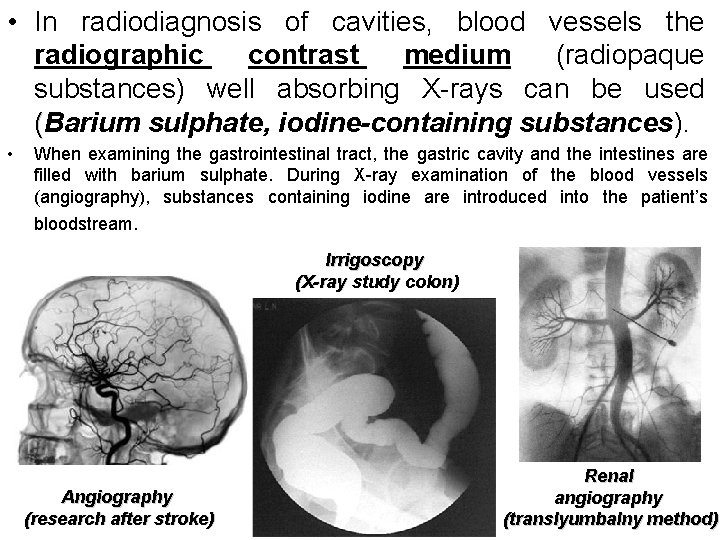  • In radiodiagnosis of cavities, blood vessels the radiographic contrast medium (radiopaque substances)