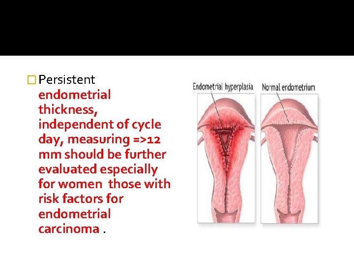 � Persistent endometrial thickness, independent of cycle day, measuring =>12 mm should be further