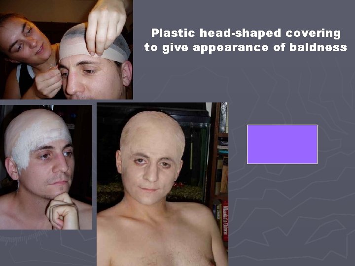 Plastic head-shaped covering to give appearance of baldness SKULL CAP 