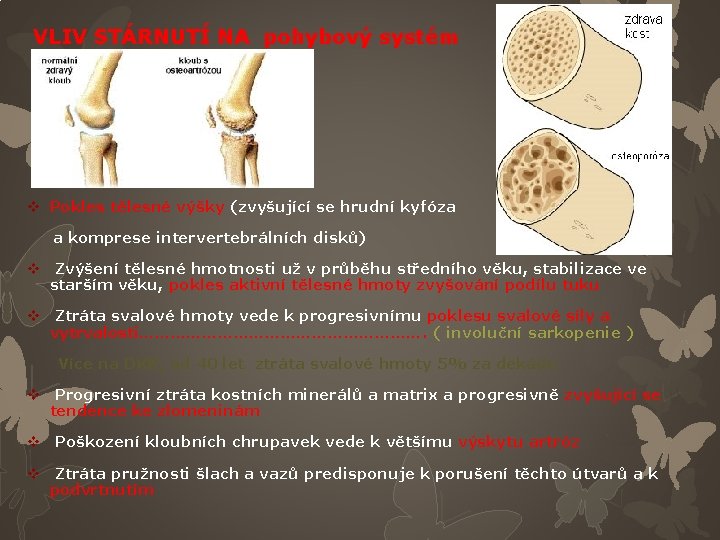 VLIV STÁRNUTÍ NA pohybový systém v Pokles tělesné výšky (zvyšující se hrudní kyfóza a