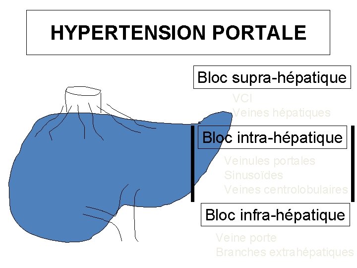 HYPERTENSION PORTALE Bloc supra-hépatique VCI Veines hépatiques Bloc intra-hépatique Veinules portales Sinusoïdes Veines centrolobulaires
