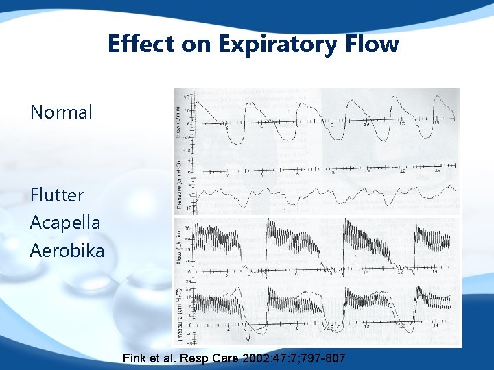 Effect on Expiratory Flow Normal Flutter Acapella Aerobika Fink et al. Resp Care 2002: