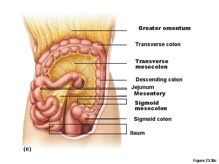 Greater omentum Transverse colon Transverse mesocolon Descending colon Jejunum Mesentery Sigmoid mesocolon Sigmoid colon Greater omentum Transverse colon Transverse mesocolon Descending colon Jejunum Mesentery Sigmoid mesocolon Sigmoid colon