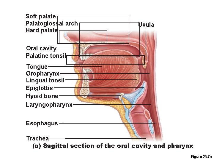Soft palate Palatoglossal arch Hard palate Uvula Oral cavity Palatine tonsil Tongue Oropharynx Lingual Soft palate Palatoglossal arch Hard palate Uvula Oral cavity Palatine tonsil Tongue Oropharynx Lingual