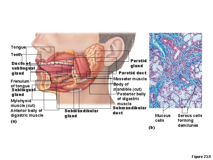Tongue Teeth Parotid gland Ducts of sublingual gland Frenulum of tongue Sublingual gland Mylohyoid Tongue Teeth Parotid gland Ducts of sublingual gland Frenulum of tongue Sublingual gland Mylohyoid