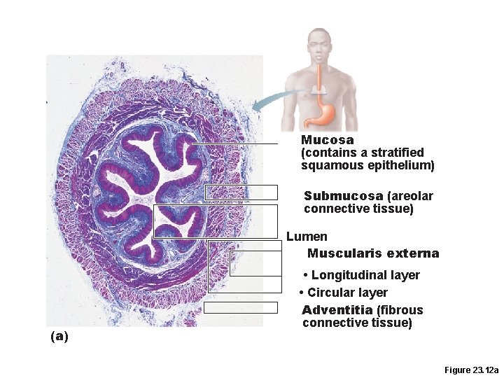 Mucosa (contains a stratified squamous epithelium) Submucosa (areolar connective tissue) Lumen Muscularis externa (a) Mucosa (contains a stratified squamous epithelium) Submucosa (areolar connective tissue) Lumen Muscularis externa (a)