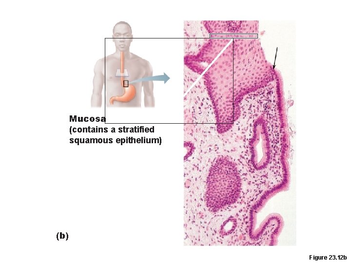 Mucosa (contains a stratified squamous epithelium) (b) Figure 23. 12 b Mucosa (contains a stratified squamous epithelium) (b) Figure 23. 12 b
