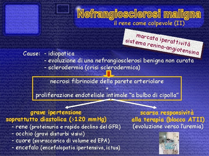 il rene come colpevole (II) marcat a ipera sistem ttività a renin a-angio tensina