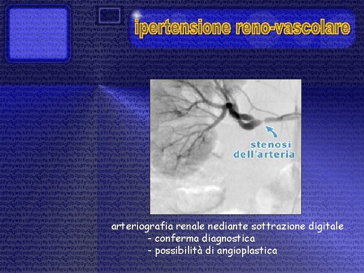 arteriografia renale nediante sottrazione digitale - conferma diagnostica - possibilità di angioplastica 