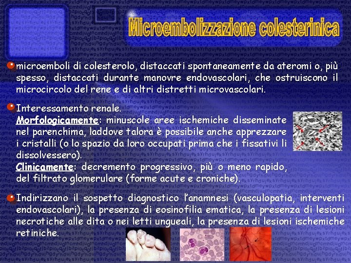 microemboli di colesterolo, distaccati spontaneamente da ateromi o, più spesso, distaccati durante manovre endovascolari,