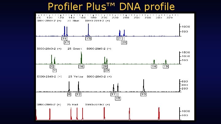 Profiler Plus™ DNA profile 