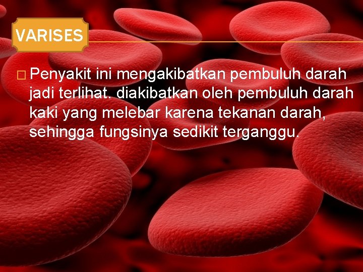 VARISES � Penyakit ini mengakibatkan pembuluh darah jadi terlihat. diakibatkan oleh pembuluh darah kaki