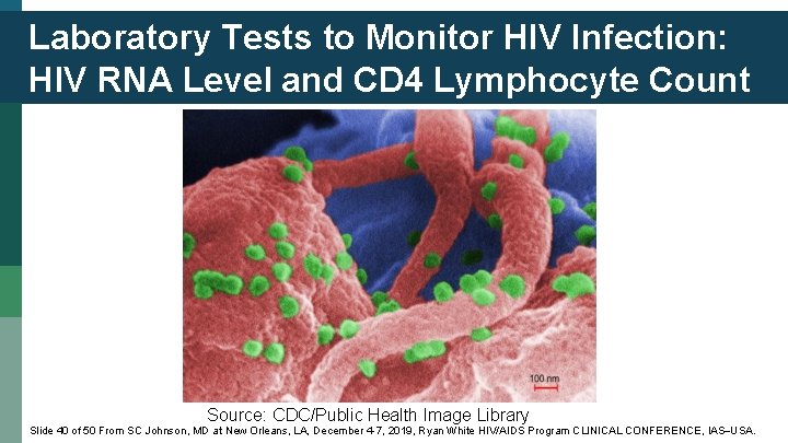 Laboratory Tests to Monitor HIV Infection: HIV RNA Level and CD 4 Lymphocyte Count