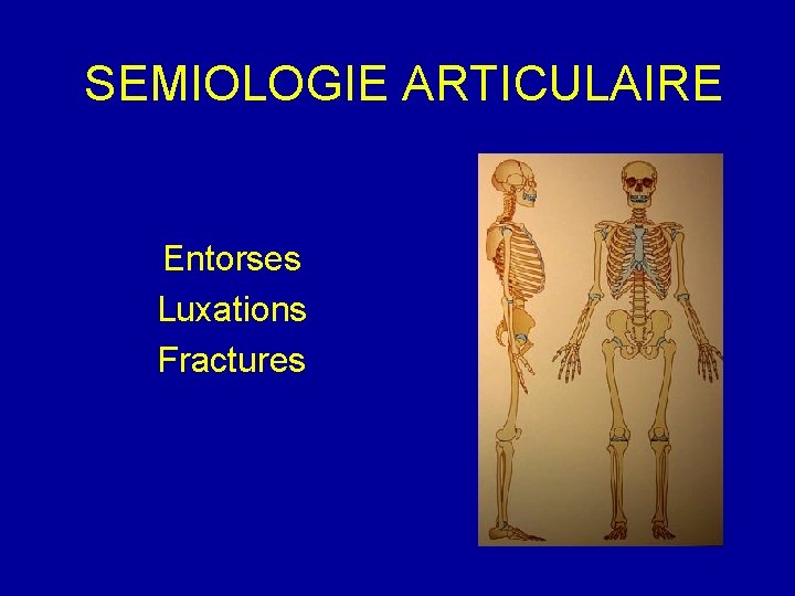 SEMIOLOGIE ARTICULAIRE Entorses Luxations Fractures 