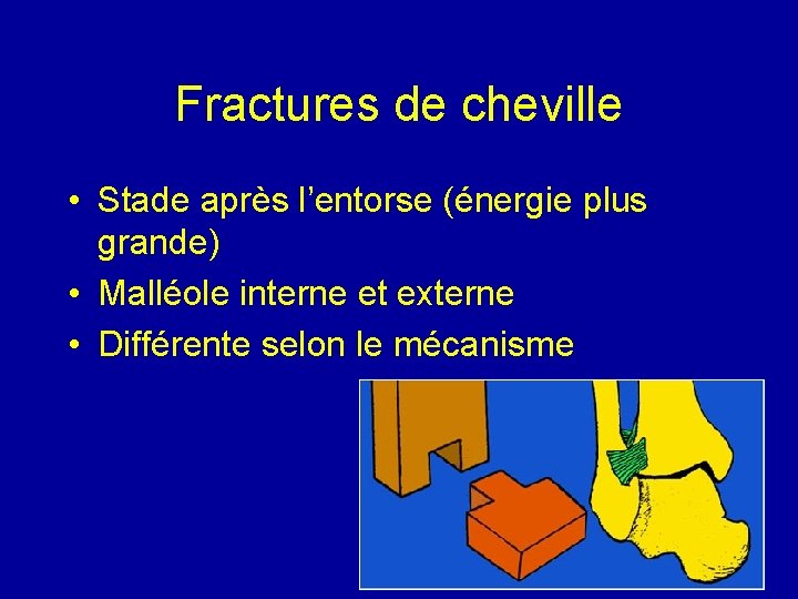 Fractures de cheville • Stade après l’entorse (énergie plus grande) • Malléole interne et