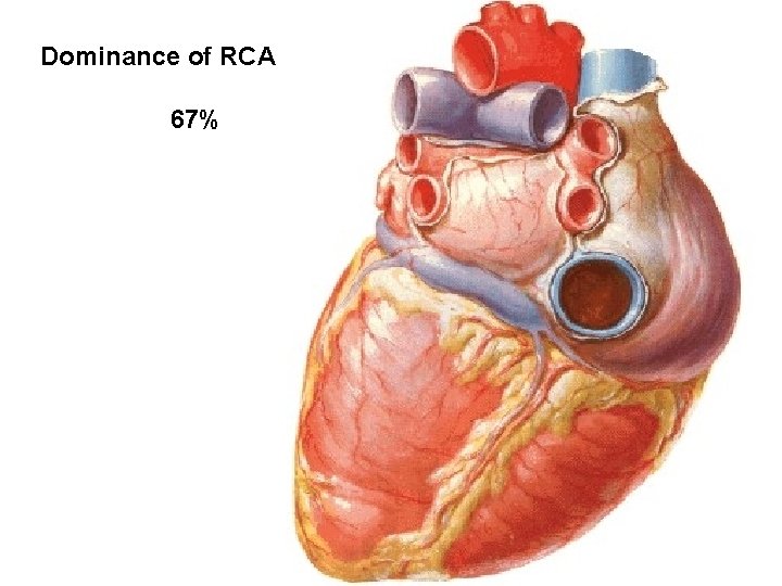 Dominance of RCA 67% 