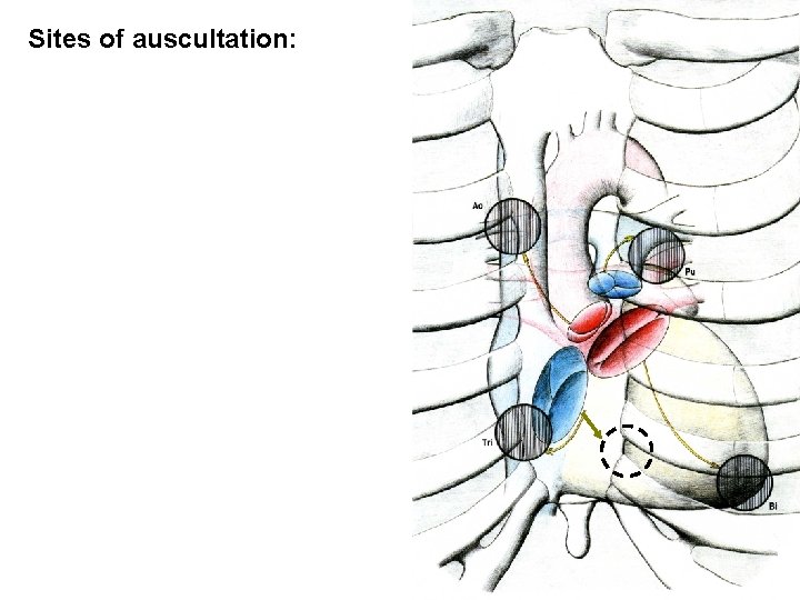 Sites of auscultation: 