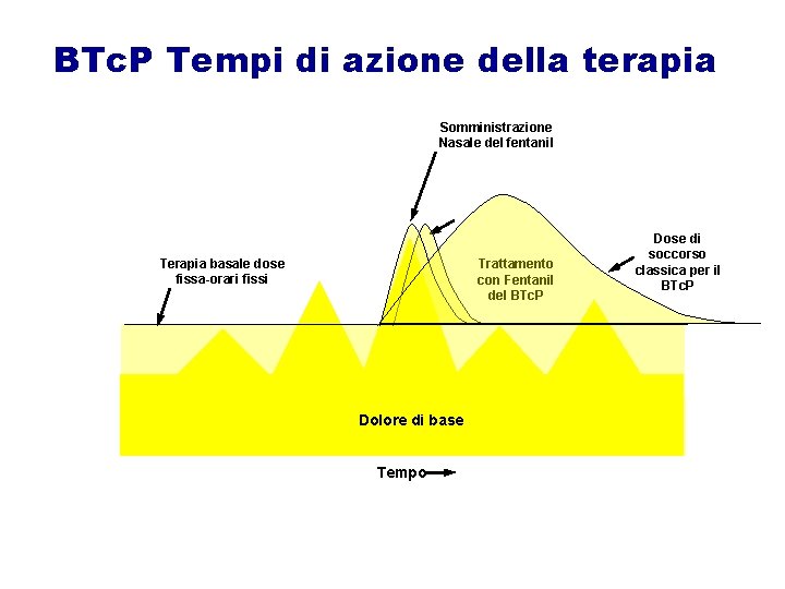 BTc. P Tempi di azione della terapia Somministrazione Nasale del fentanil Terapia basale dose