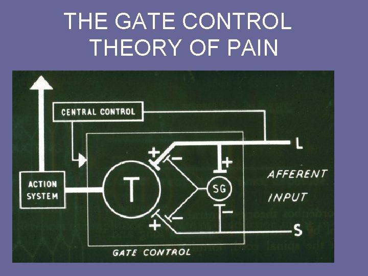 THE GATE CONTROL THEORY OF PAIN 