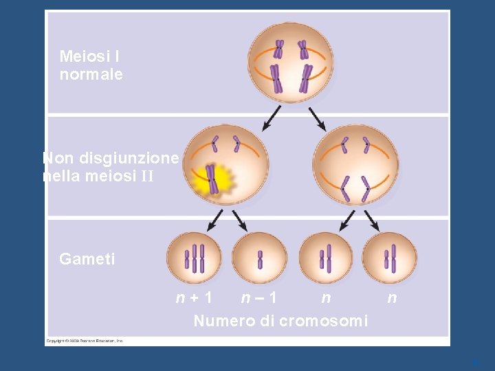 Meiosi I normale Non disgiunzione nella meiosi II Gameti n+1 n– 1 n Numero