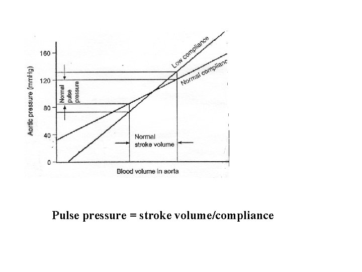 Pulse pressure = stroke volume/compliance 