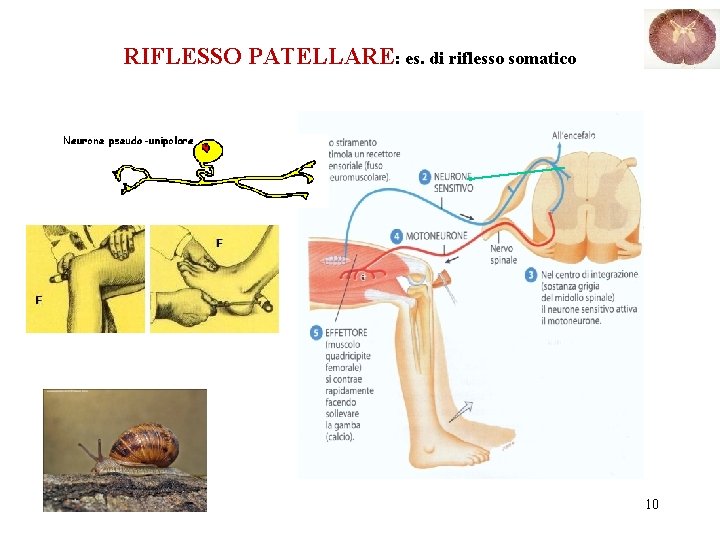 RIFLESSO PATELLARE: es. di riflesso somatico 10 