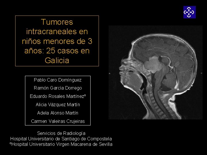 Tumores intracraneales en niños menores de 3 años: 25 casos en Galicia Pablo Caro