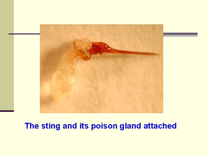 The sting and its poison gland attached 