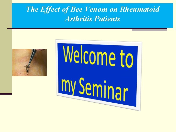 The Effect of Bee Venom on Rheumatoid Arthritis Patients 