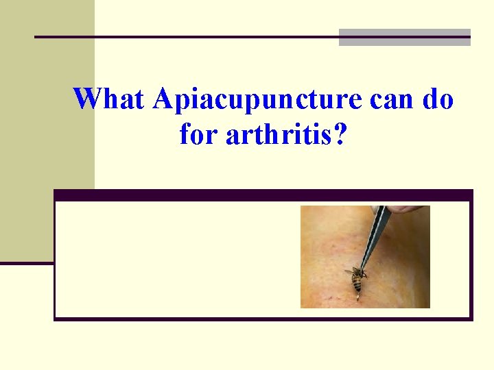 What Apiacupuncture can do for arthritis? 