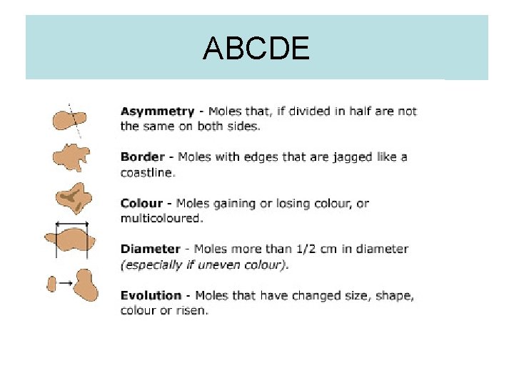 ABCDE 