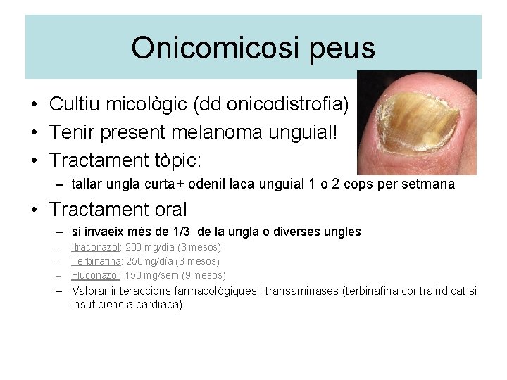 Onicomicosi peus • Cultiu micològic (dd onicodistrofia) • Tenir present melanoma unguial! • Tractament