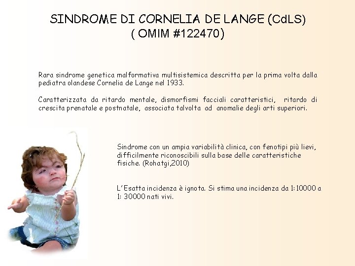 LA SINDROME DI CORNELIA DE LANGE Dott ssa