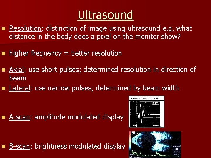 Ultrasound n Resolution: distinction of image using ultrasound e. g. what distance in the