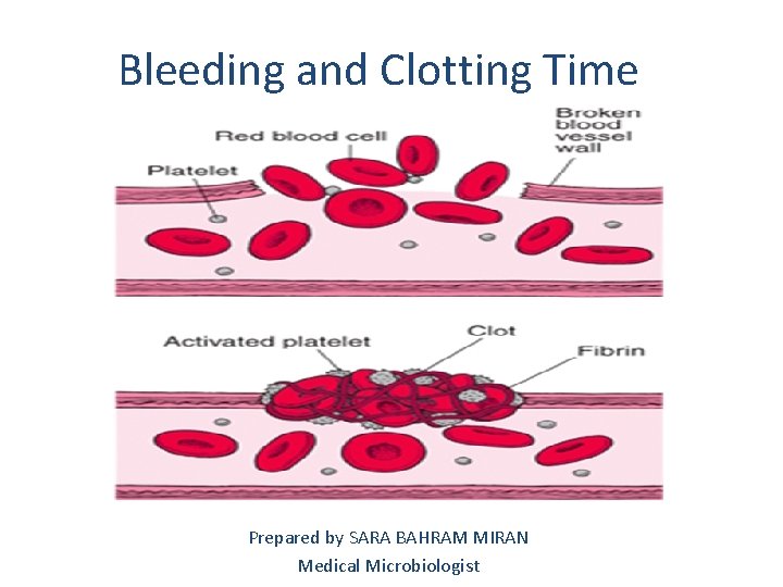 Bleeding and Clotting Time Prepared by SARA BAHRAM MIRAN Medical Microbiologist 