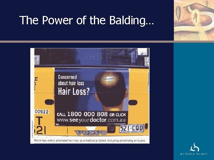 The Power of the Balding… 