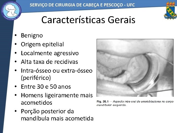 Características Gerais Benigno Origem epitelial Localmente agressivo Alta taxa de recidivas Intra-ósseo ou extra-ósseo