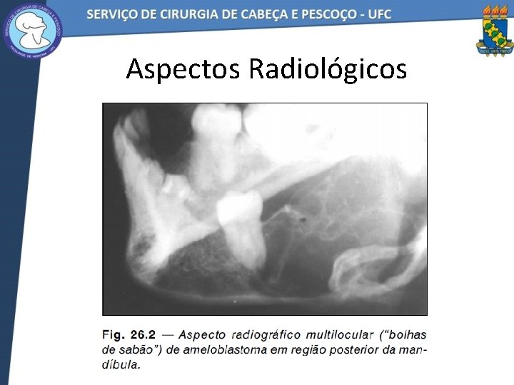 Aspectos Radiológicos 