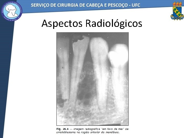 Aspectos Radiológicos 