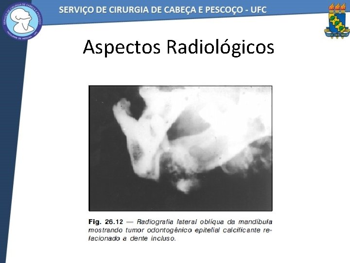 Aspectos Radiológicos 