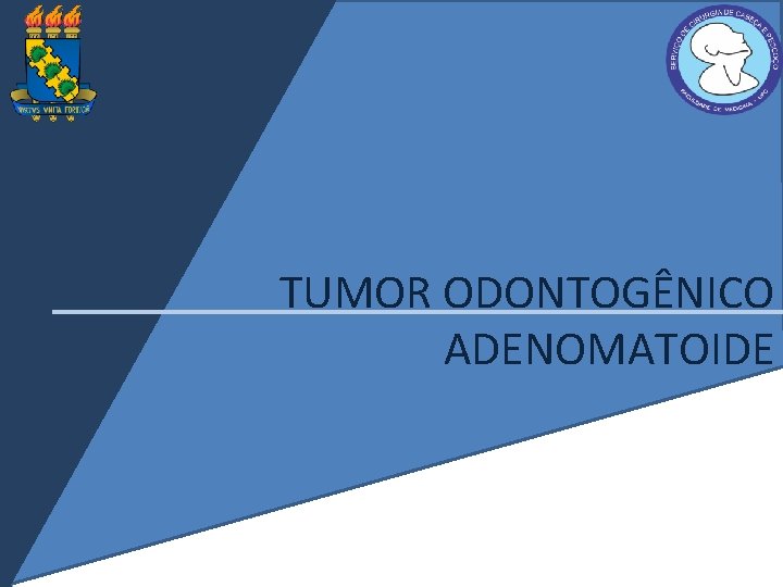 TUMOR ODONTOGÊNICO ADENOMATOIDE 